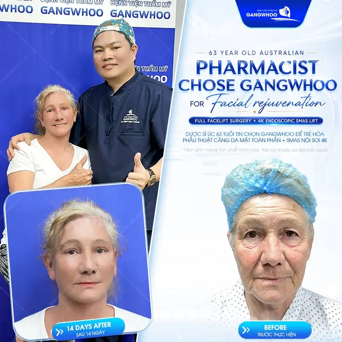 Nữ Y tá 63 tuổi đến từ Úc sau phẫu thuật căng da mặt toàn phần đã lột xác 1 cách đầy ngoạn mục