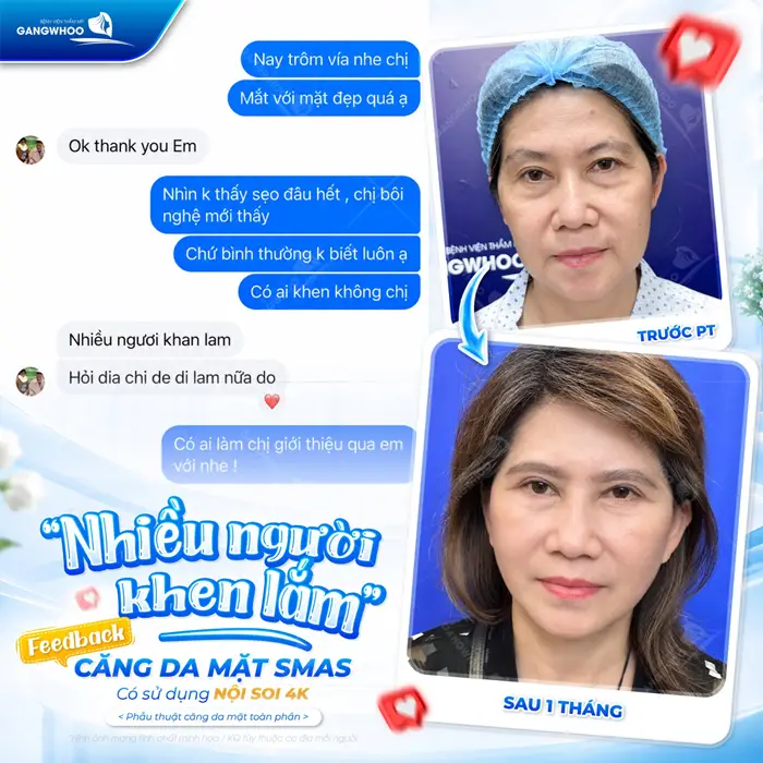 khach hang fb sau cang da mat smas co su dung noi soi 4k nhieu nguoi khen lam
