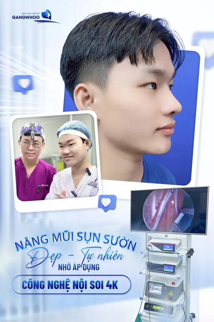 Nâng Mũi Sụn Sườn Có Bị Teo Lại Không? Dr.Robert Giải Đáp