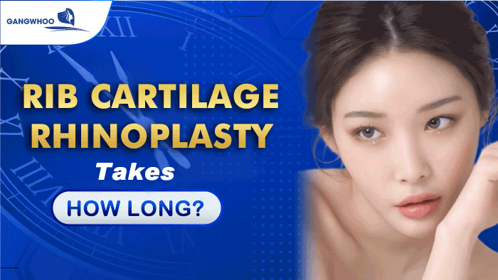 recover from rib cartilage rhinoplasty
