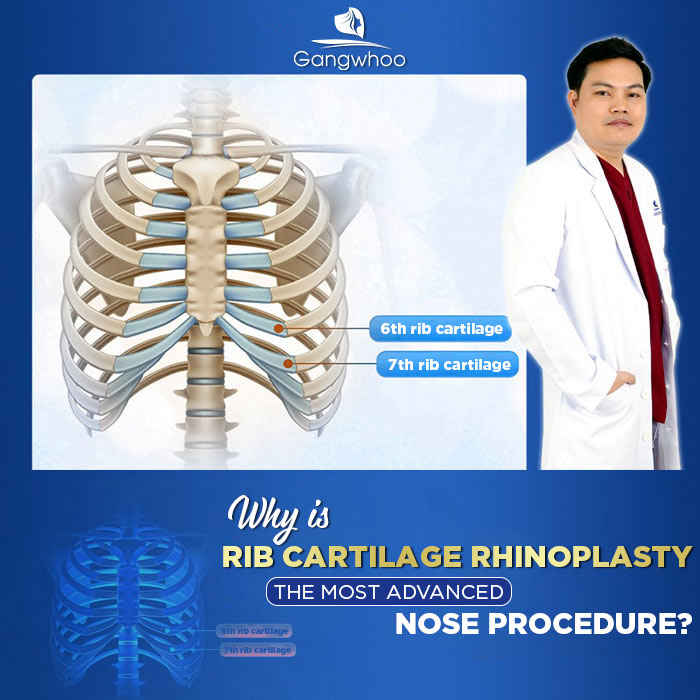 pros and cons of rib cartilage rhinoplasty 1