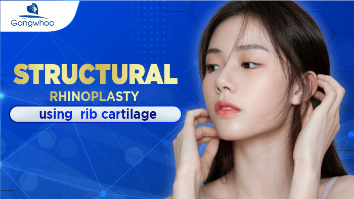 Structural Rhinoplasty with Rib cartilage