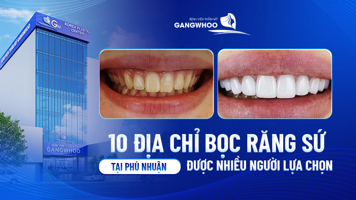 boc rang su tai phu nhuan 1
