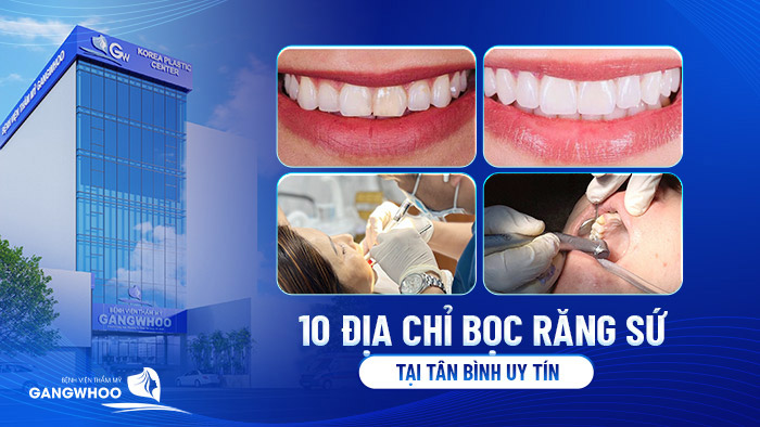 boc rang su uy tin tai tan binh