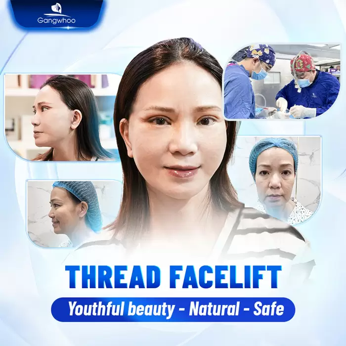 Firin Nano Collagen: A Revolutionary Facelift Technique with Thread Rejuvenation 5 cang da mat bang chi en 1