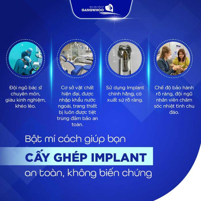 Top Những Điểm Đến Cấy Ghép Implant Tại TPHCM Uy Tín Chất Lượng