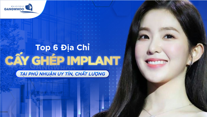 Top 6 Địa Chỉ Cấy Ghép Implant Tại Phú Nhuận Uy Tín, Chất Lượng