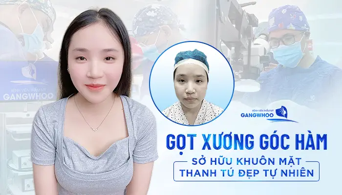 got xuong ham 21