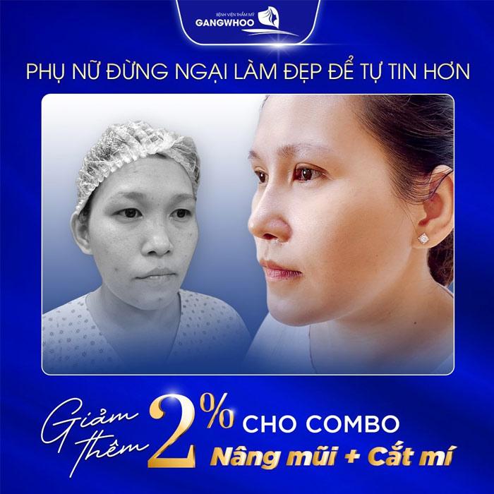 nang mui boc sun can 1