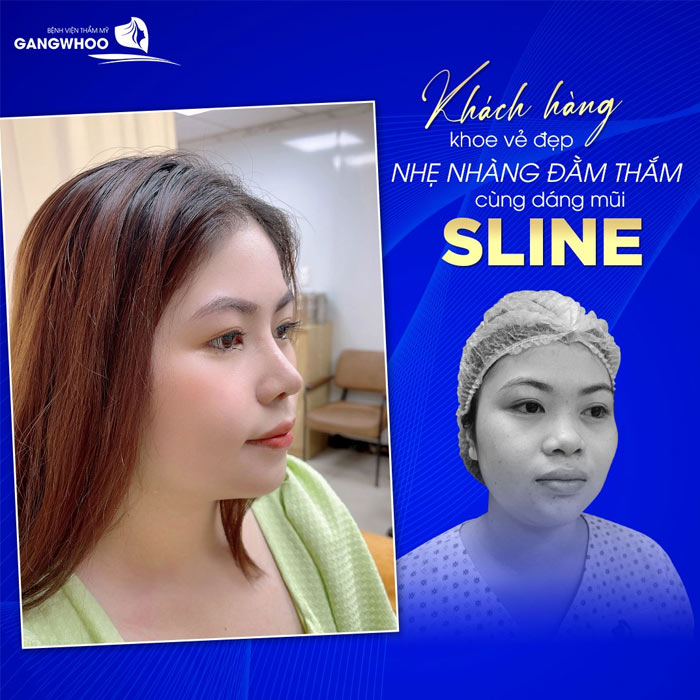 nang mui boc sun can 2