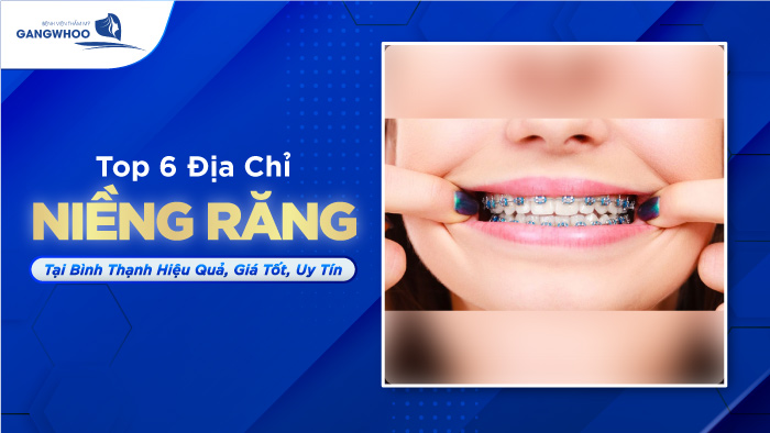 Top 6 Địa Chỉ Niềng Răng Tại Bình Thạnh Hiệu Quả, Giá Tốt, Uy Tín