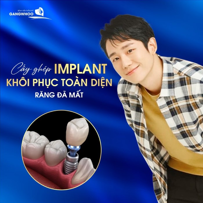 Cấy Ghép Implant Hàn Quốc Có Tốt Không? Chi Phí Bao Nhiêu?
