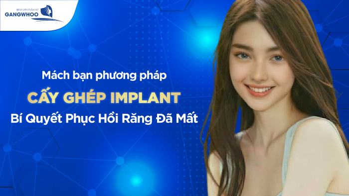 Tại Sao Phải Cấy Ghép Implant? Bác Sĩ Giải Đáp