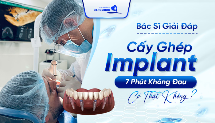 Cấy Ghép Implant 7 Phút Không Đau CÓ Thật Không? Bác Sĩ Giải Đáp 28 Cấy Ghép Implant 7 Phút Không Đau
