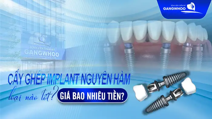 cay ghep implant nguyen ham