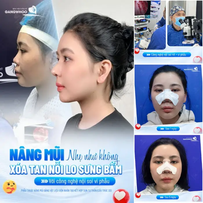 Phẫu thuật nội soi vi phẫu hồi phục nhanh, không lo sưng tím hay đau nhức