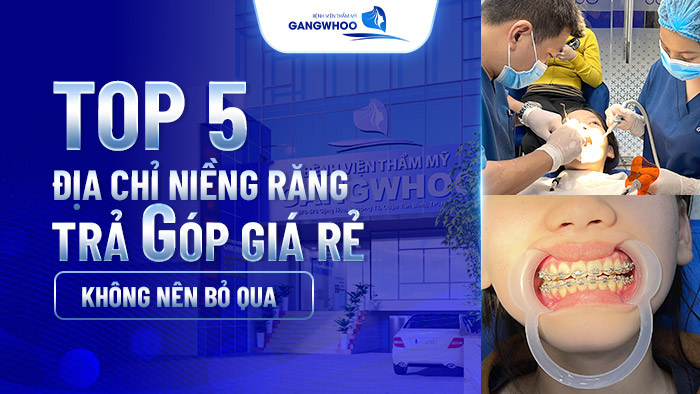 dia chi nieng rang tra gop 5