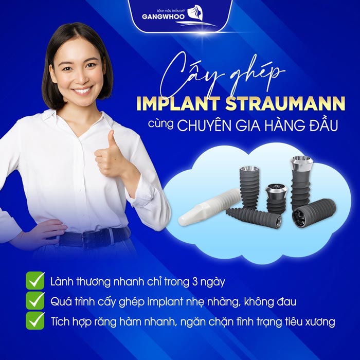 dia chi trong rang implant tra gop 1