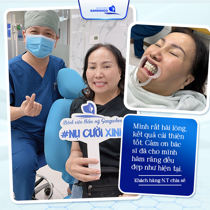 Cấy Ghép Implant Giá Rẻ