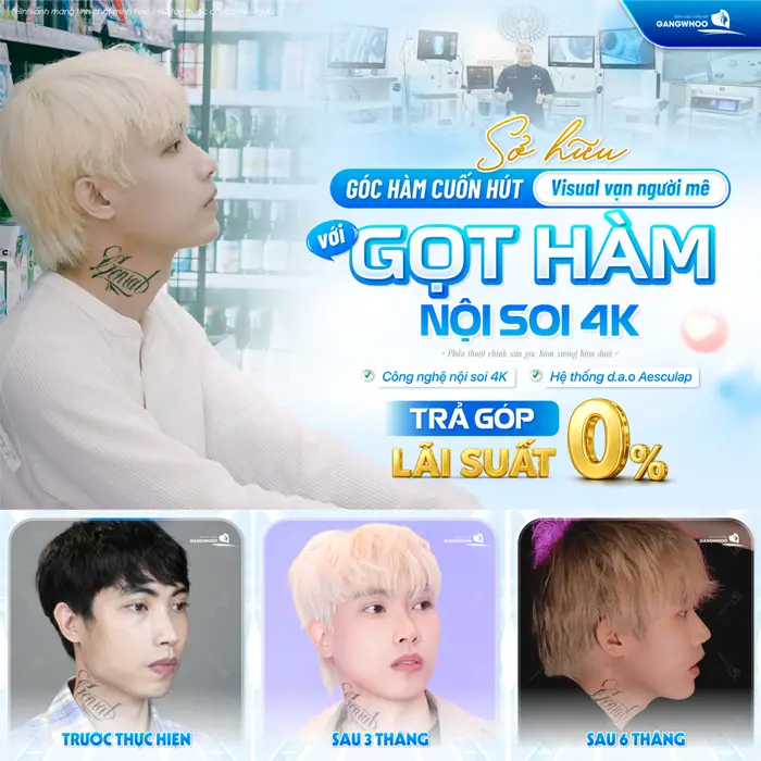 Sở hữu góc hàm cuốn hút visual đẹp thẳng hạng với công nghệ gọt hàm nội soi 4K hiện đại