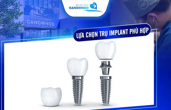 Kinh Nghiệm Cấy Ghép Implant