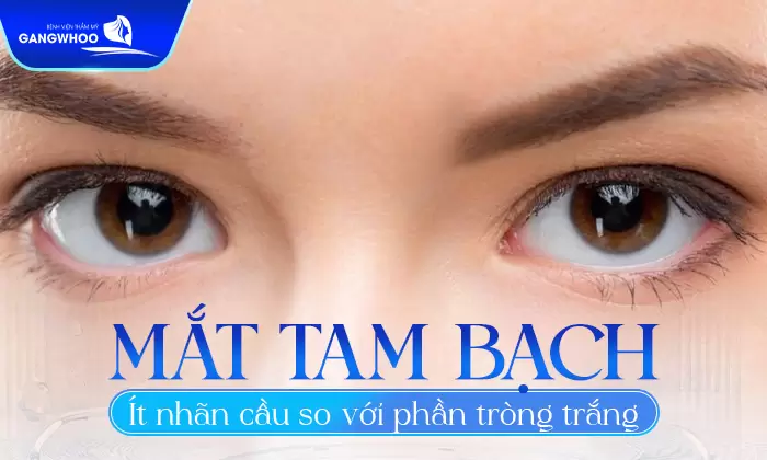 Mắt Tam Bạch Là Gì? Tướng Số Người Có Mắt Tam Bạch 15 Mắt tam bạch có hiện tượng phần nhãn cầu ít hơn so với phần tròng trắng