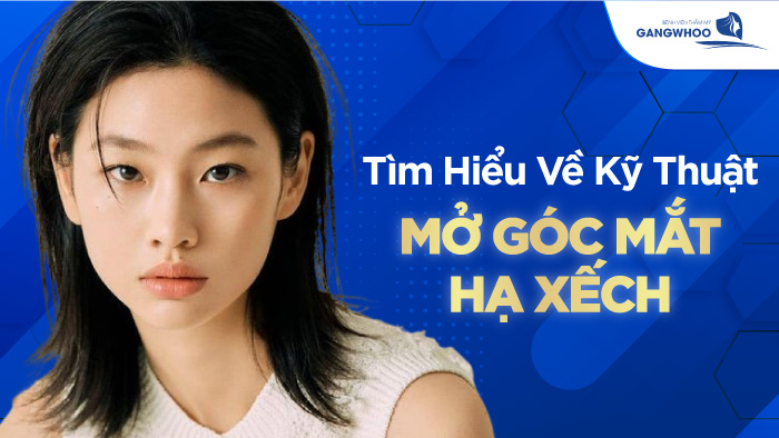 mo goc mat ha