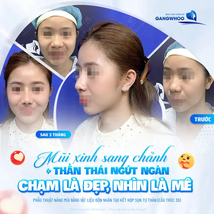 Mũi xinh sang chảnh thần thái ngút ngàn chạm là đẹp nhìn là say mê