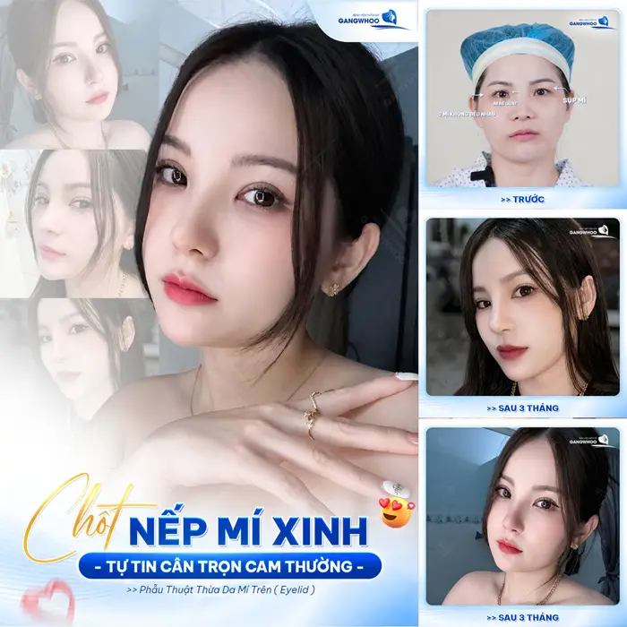 Nếp mí đẹp xinh tự tin cân trọn cam thường nhan sắc đẹp chuẩn thần thái Hot girl 