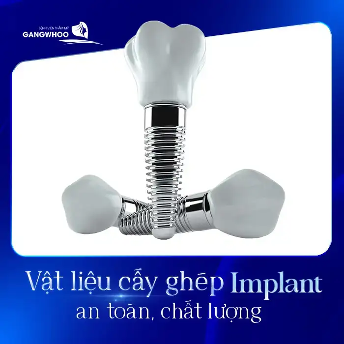 Cấy Ghép Implant 7 Phút Không Đau CÓ Thật Không? Bác Sĩ Giải Đáp 34 Cấy Ghép Implant 7 Phút Không Đau