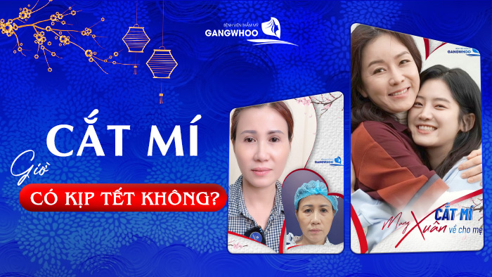 cat mi gio co kip tet khong