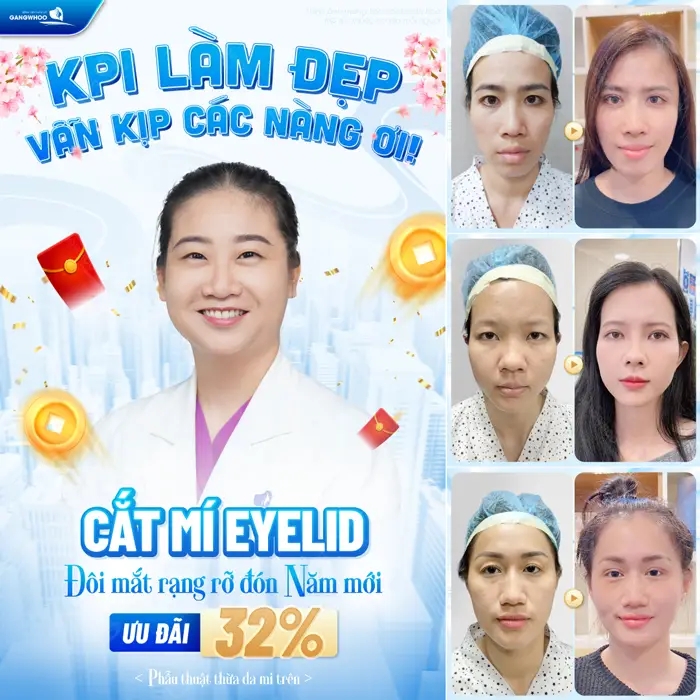 Mắt đẹp đón năm mới thêm rạng rỡ và đầy sức sống tự tin chào đón năm mới rạng rỡ