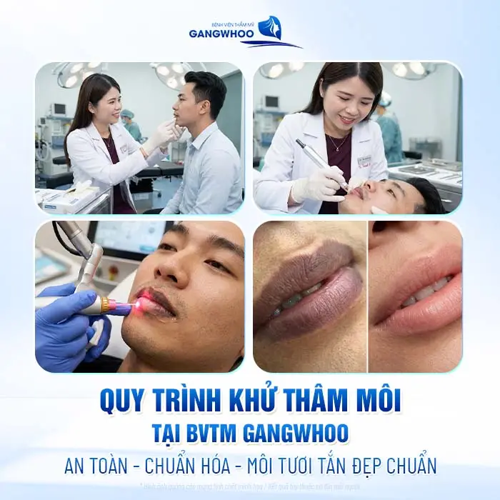 4 Phương Pháp Khử Thâm Môi Nam Giới Hiệu Quả Chuẩn Men