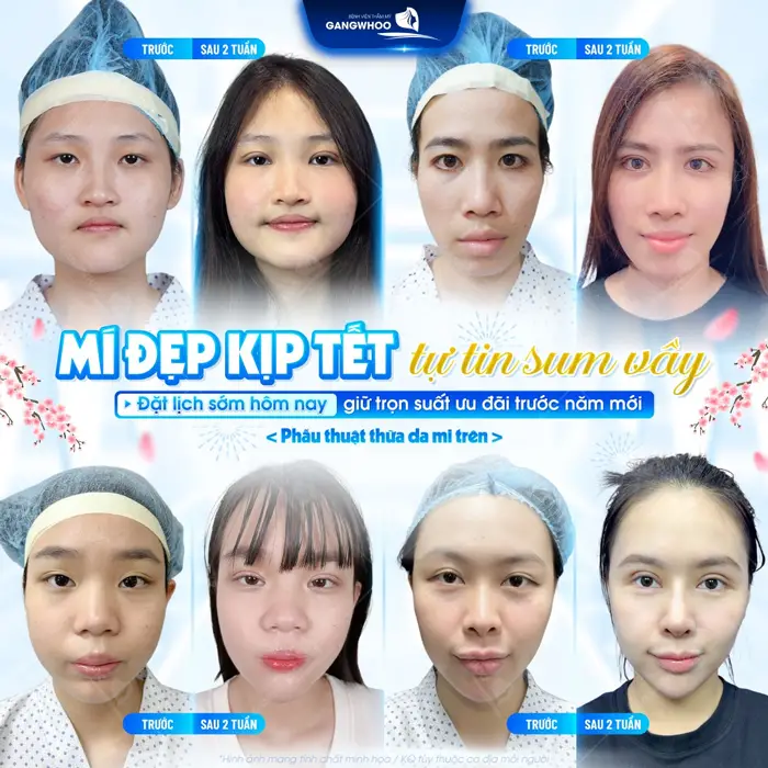 Mí đẹp kịp đón tết tự itn sum vầy giữ trọn ánh nhìn rạng rỡ cho năm mới thêm tỏa sáng