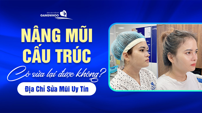 nang mui cau truc co sua lai duoc khong