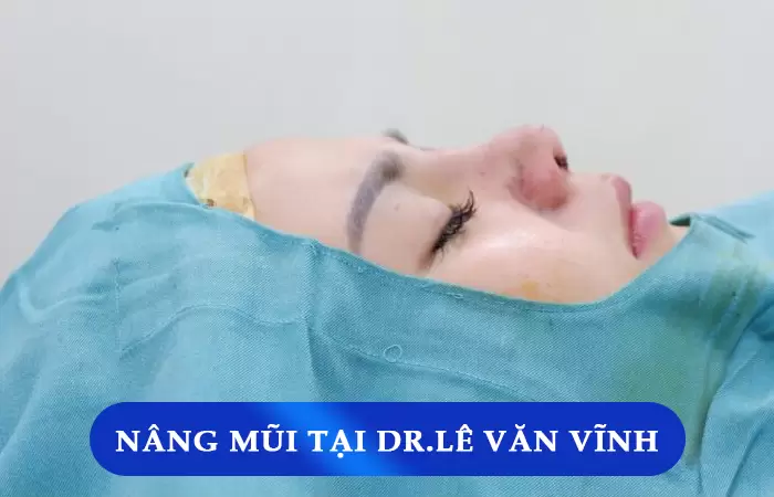 Danh Sách Top 5 Bác Sĩ Nâng Mũi Cấu Trúc Giỏi Hiện Nay 14 Danh Sách Top 5 Bác Sĩ Nâng Mũi Cấu Trúc Giỏi Hiện Nay