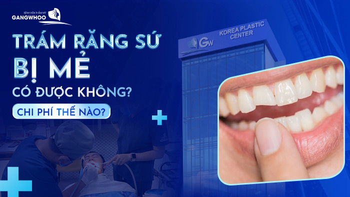 tram rang su bi me co duoc khong 2