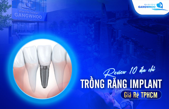 trong rang implant gia re tphcm
