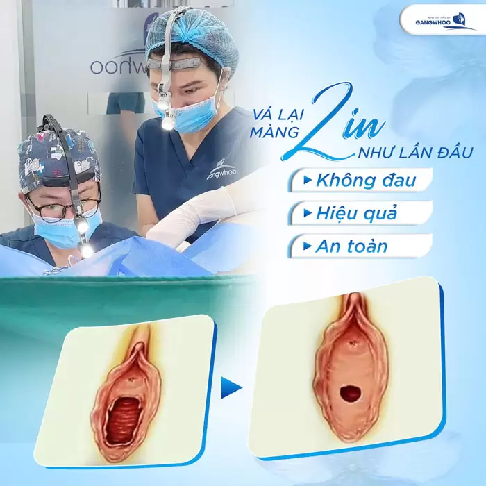 Chi Phí Vá Màng Trinh Là Bao Nhiêu Năm 2025? Địa Chỉ Vá Màng Trinh? 1 Vá màng zin đẹp như lần đầu tiên không đau, hiệu quả và an toàn