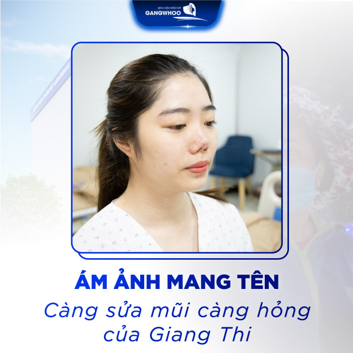 Nụ Cười Lại Rực Rỡ Trên Gương Mặt Giang Thi Sau 4 Lần Sửa Mũi Hỏng