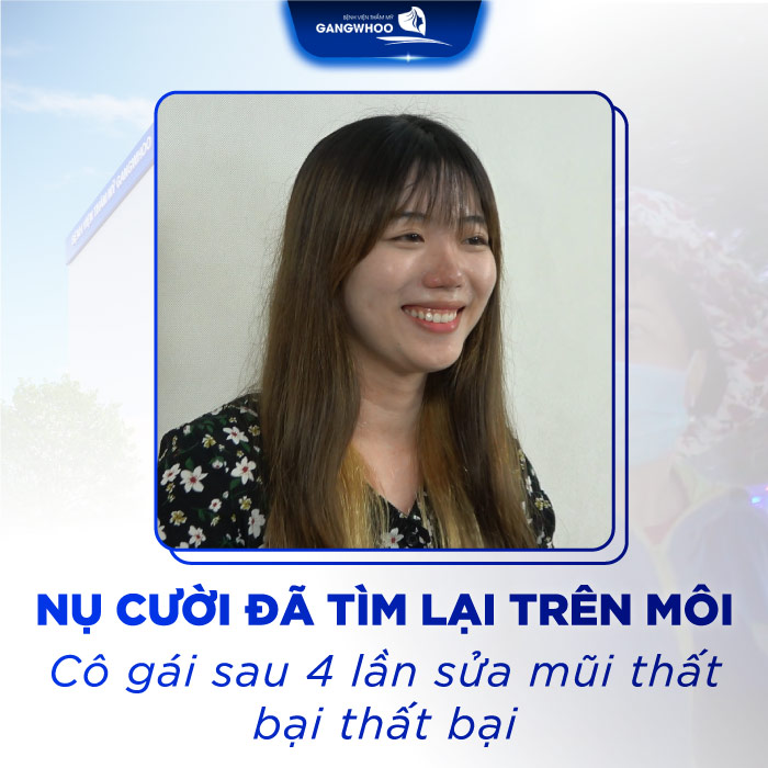 Nụ Cười Lại Rực Rỡ Trên Gương Mặt Giang Thi Sau 4 Lần Sửa Mũi Hỏng