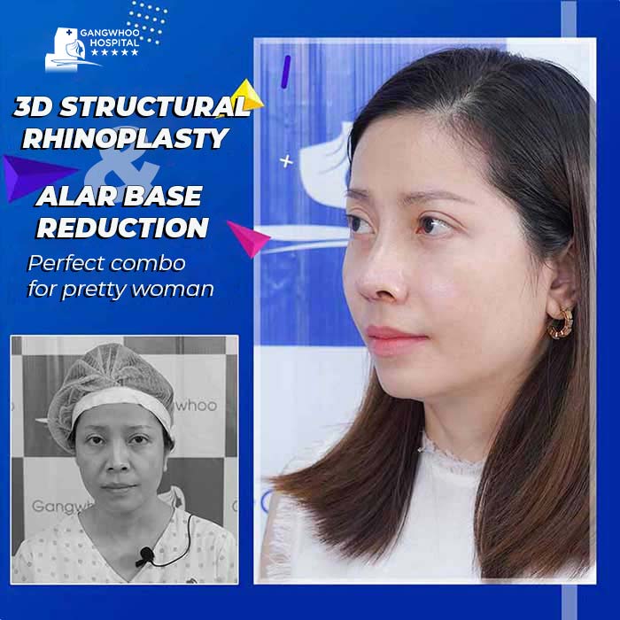 hinh anh khach hang thu gon canh mui 2
