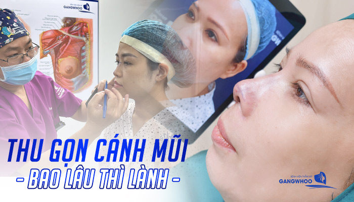 Thu Gọn Cánh Mũi Bao Lâu Thì Lành