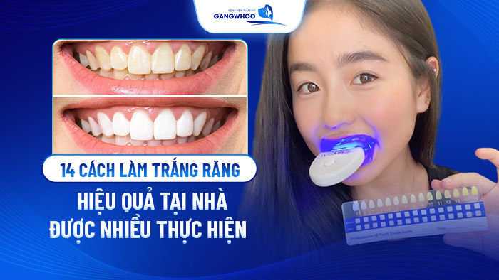 cach lam trang rang hieu qua tai nah
