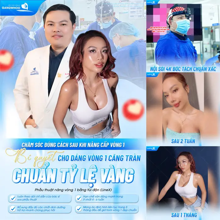 Chăm sóc đúng cách sau nâng cấp vòng 1 bí quyết cho sắc vóc đẹp căng tràn chuẩn tỷ lệ vàng