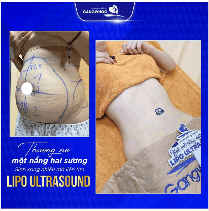 1 bát cơm bao nhiêu calo