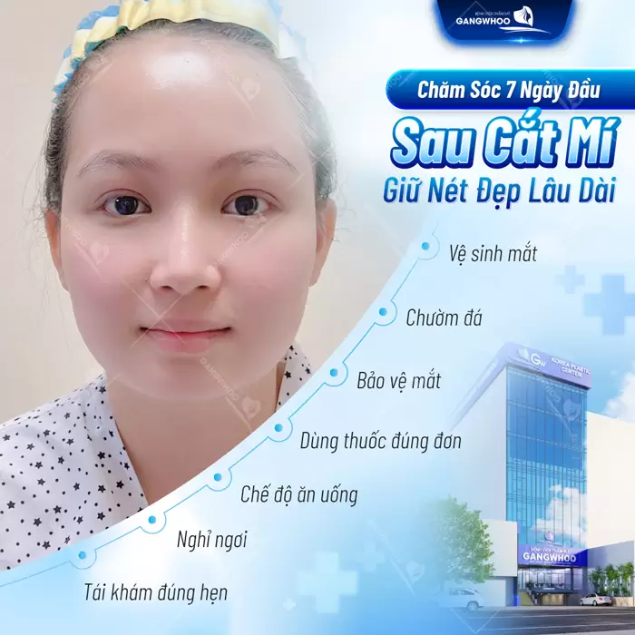 Chăm sóc sau cắt mí là một điều cần thiết để quá trình hồi phục diễn ra nhanh chóng và sớm hồi phục