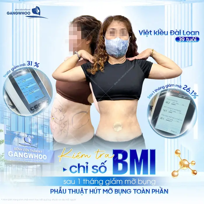 Việt kiều Đài Loan kiểm tra chỉ số BMI sau 1 tháng giảm mỡ bụng đã đạt chỉ số đẹp thấy rõ