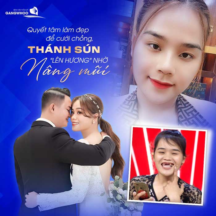 nang mui phong thuy8