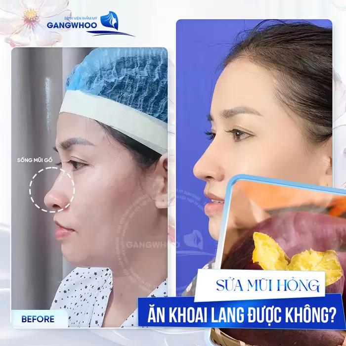 sua mui hong an khoai lang duoc khong